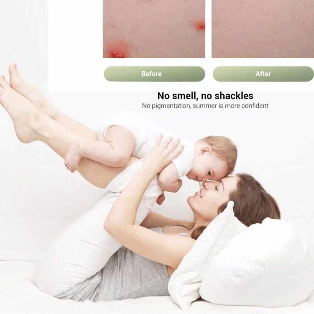 Xiaomi AGW-06 Antipruritic Mosquito Insect Bite Relieve Itching Pen Plant Cooling Soothing Rod