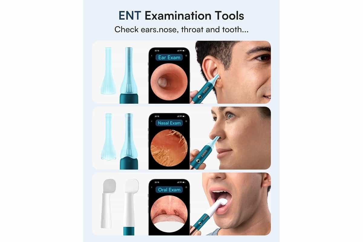 Xiaomi Bebird Earsight Ultra Ear Wax Removal Tool Camera